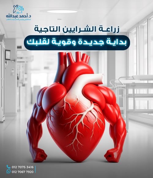 عملية القلب النابض لترقيع الشرايين التاجية - دكتور احمد عبدلله