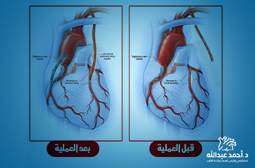 نتائج-رائعة-للحالات-المستعصية